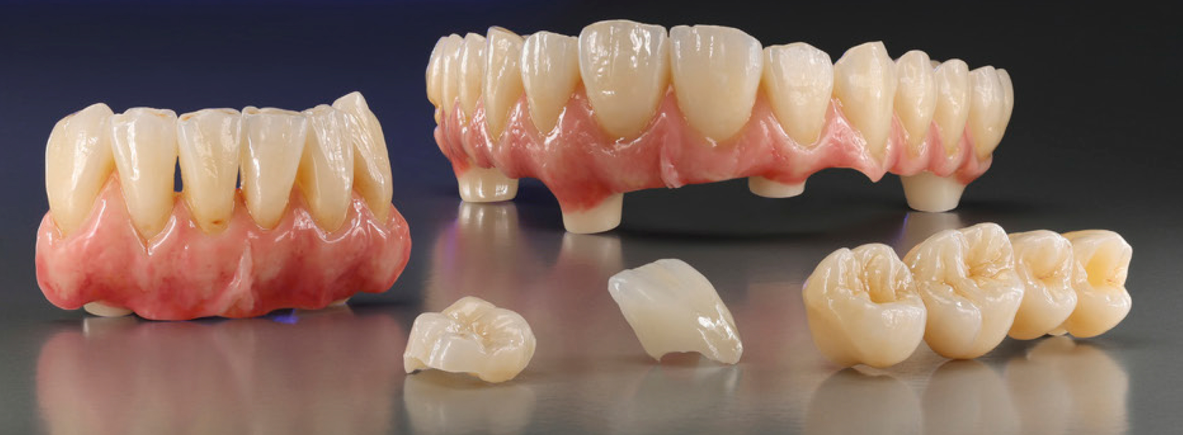 773536_BRO_IPS_emax_Zirconia_2026_EN.indd